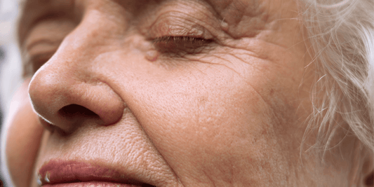 What Age to Start Using Antiaging Skin Care Products